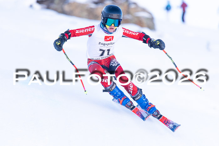 1. BZB CUP RS, 04.01.2026 