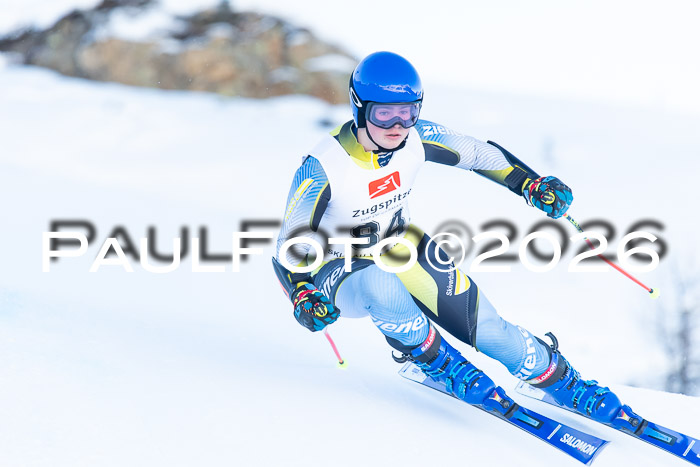 1. BZB CUP RS, 04.01.2026 