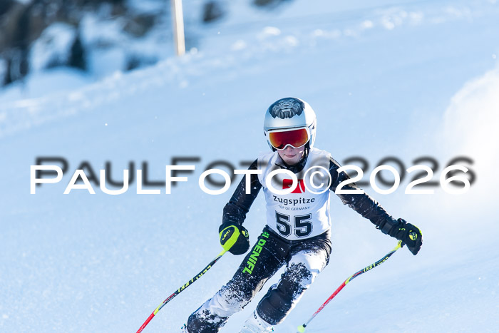 1. BZB CUP RS, 04.01.2026 