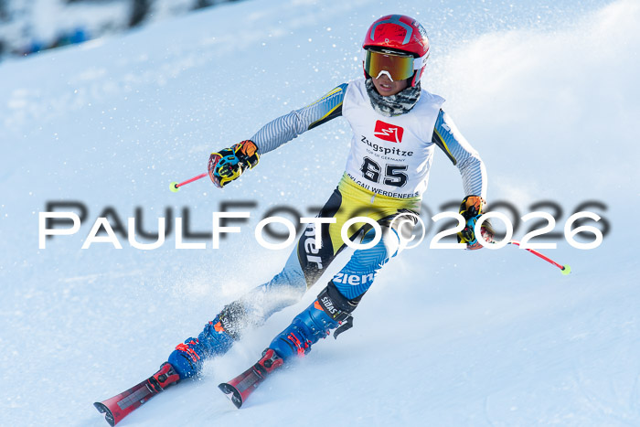 1. BZB CUP RS, 04.01.2026 