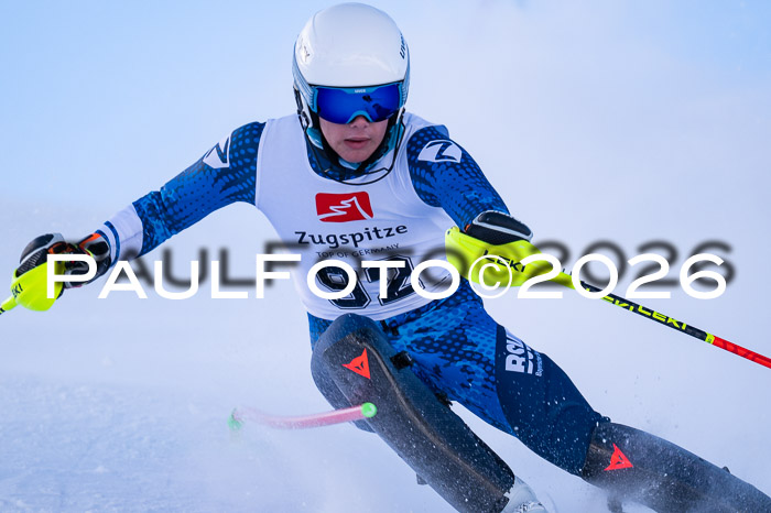 2. BZB CUP SL, 05.01.2026 